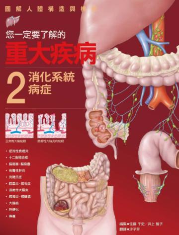 您一定要了解的重大疾病 （2）：消化系統病症