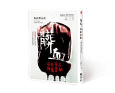 髒血:塔斯基吉梅毒實驗