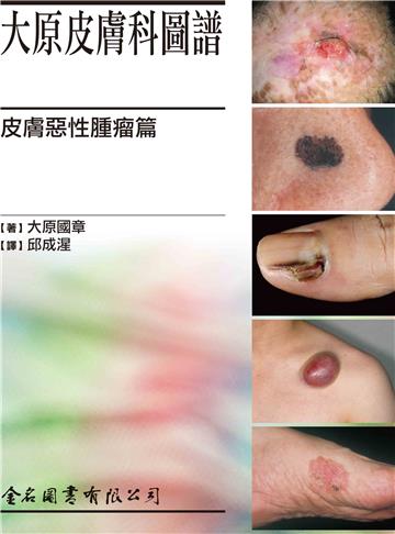 大原皮膚科圖譜：皮膚惡性腫瘤篇