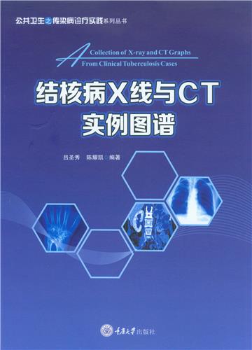 结核病X线与CT实例图谱