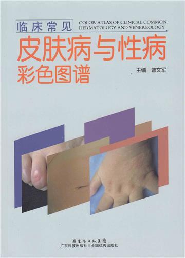 临床常见皮肤病与性病彩色图谱