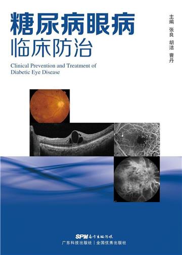糖尿病眼病临床防治