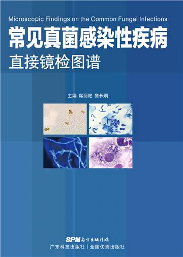 常见真菌感染性疾病直接镜检图谱