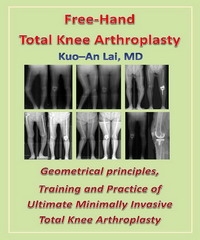 Free─Hand Total Knee Arthroplasty【有聲】